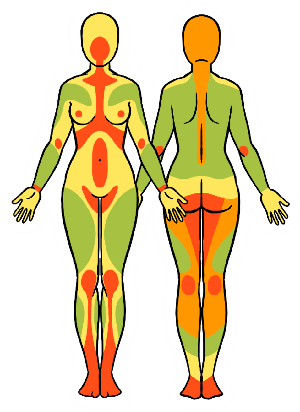 Répartition graisseuse type A