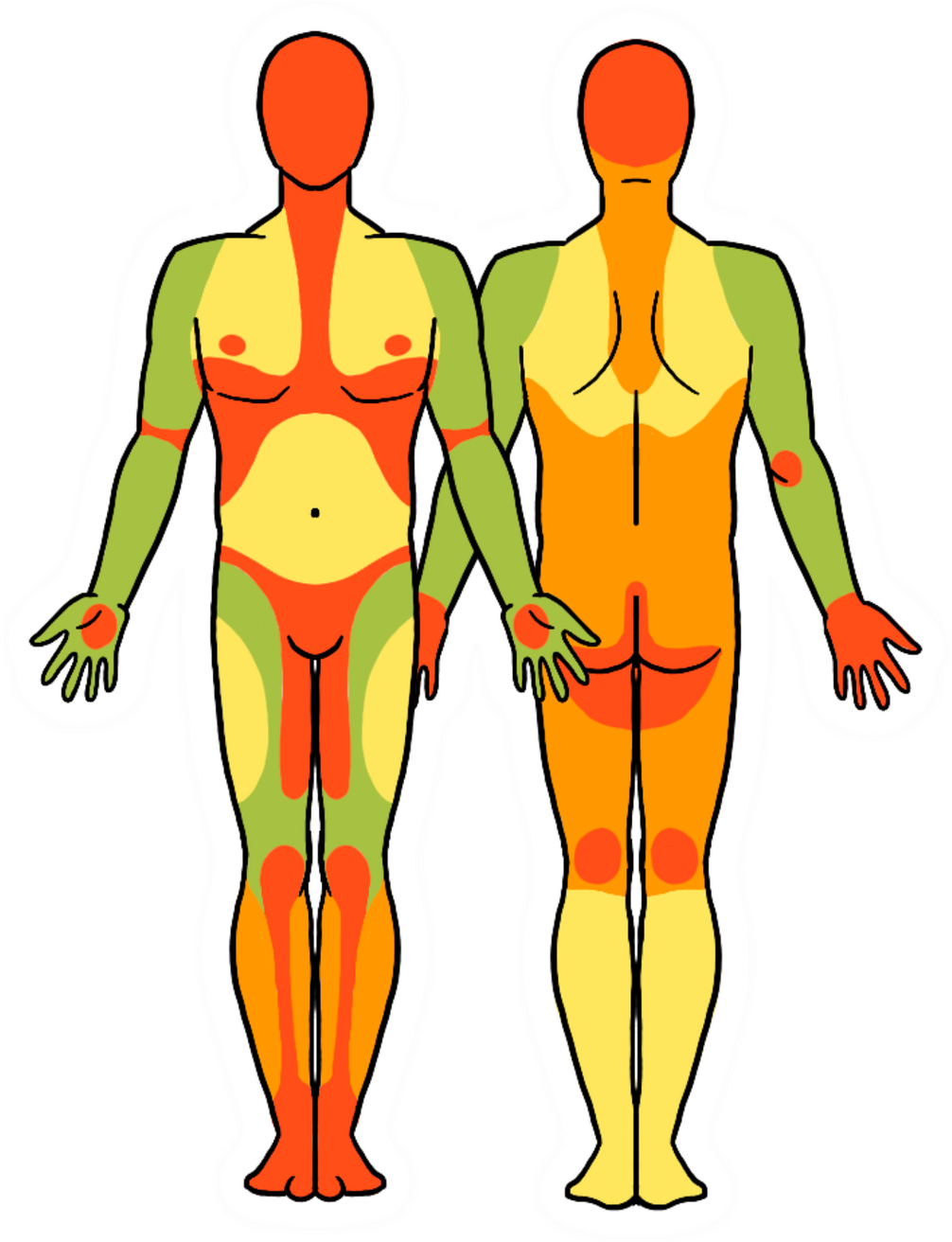 Répartition graisseuse type B
